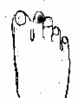 胃炎