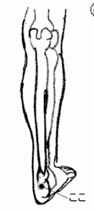 女膝(じょしつ)
