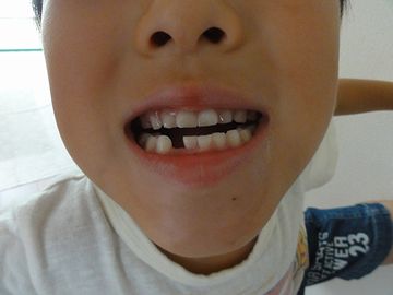一本ないの