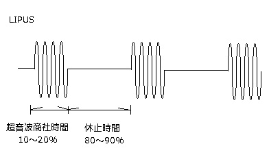 LIPUSの仕組み