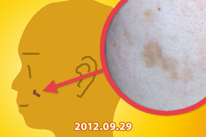 20120929シミの写真