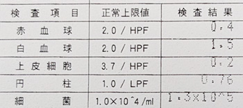 泌尿器科の尿検査結果