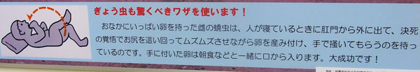 ぎょう虫説明