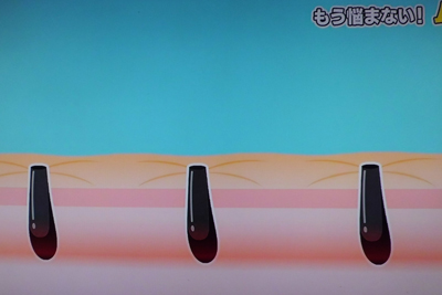 暖めてからむだ毛を剃ったところ
