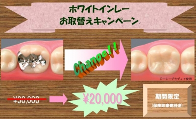 ¥Û¥ï¥¤¥È¥¤¥ó¥ì¡¼¤ª¼èÂØ¤¨¥¥ã¥ó¥Ú¡¼¥ó