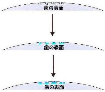 ¥È¥ê¡¼¥È¥á¥ó¥È