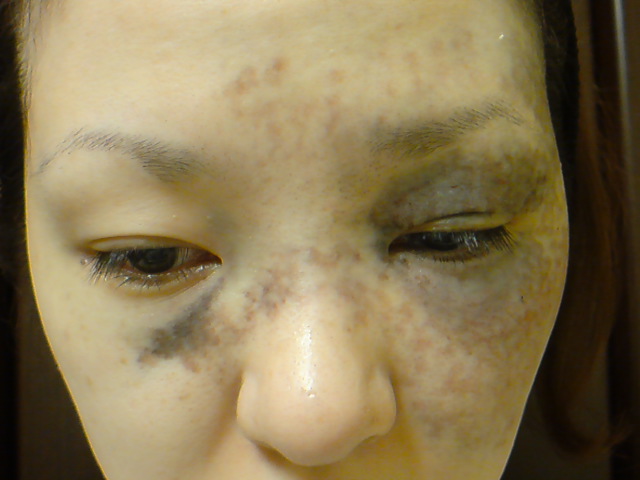 10年08月11日の記事 一念発起