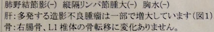 CT5月