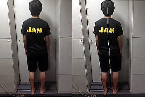 身体の姿勢画像を解析し、姿勢の曲がりを確認します。