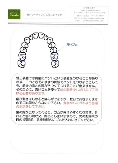 セパレートの説明書