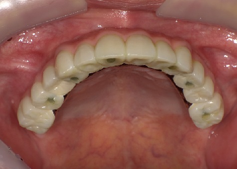 PICT0195.JPG