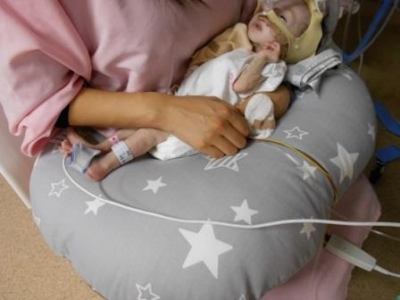 北里病院NICU 看護師　先天性心疾患　ノーウッド手術　グレン手術　フォンタンの会　フォンタン手術　こども医療センター