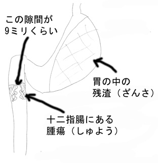 主治医の説明
