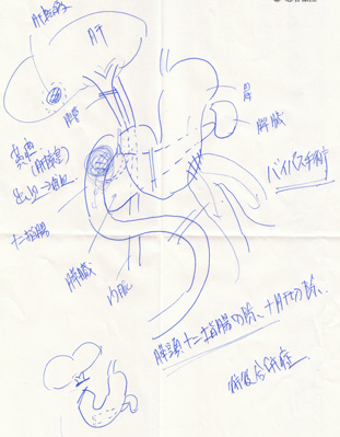 外科医の説明