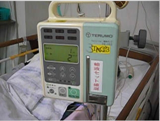 輸液量をコントロールする機械