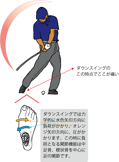 ゴルフのダウンスイングでの右足の痛み Tsuchikoカイロプラクティック オフィス ゴルファーズクリニック