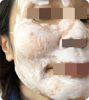 300泡パックつけた直後.jpg