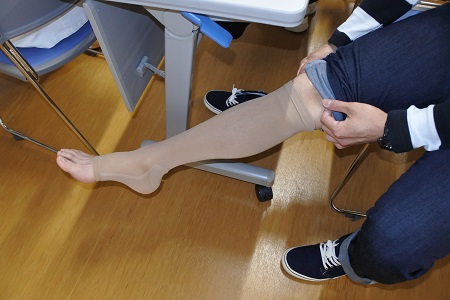 ストッキング 看護 弾性 下肢静脈瘤における医療用弾性ストッキングを用いた圧迫療法 医療用弾性ストッキングの効果と使用目的:下肢静脈瘤を正しく見極める