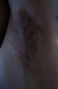 左手1218
