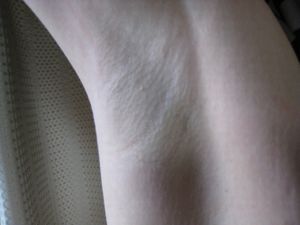 キョロさん手術前