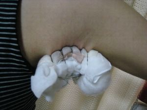 キョロさんオペ次の日