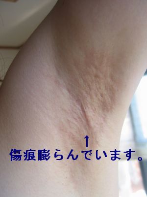 左脇