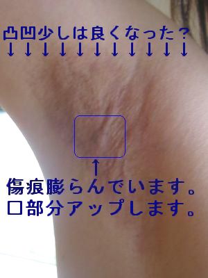 右脇