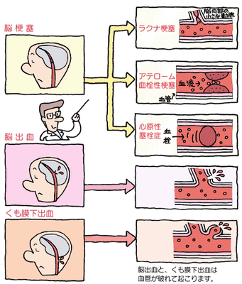 image-preview.png