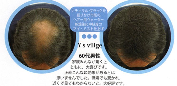 マジックパウダー 今ならまだ間に合います 薄毛対策グッズを通販で購入して髪の毛を復活させよう