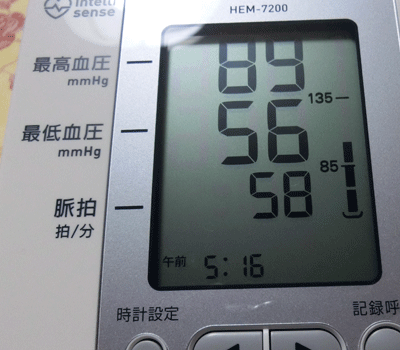 血圧計