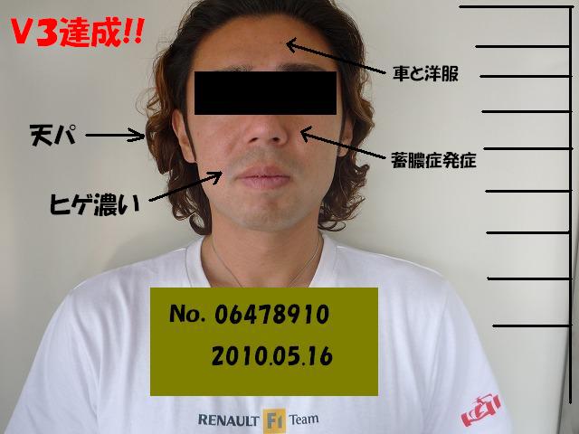 ・・・天パです