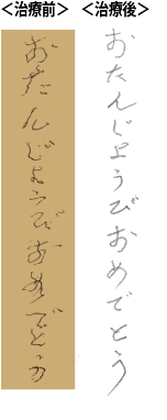 治療前と治療後の文字の変化