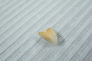 tooth
