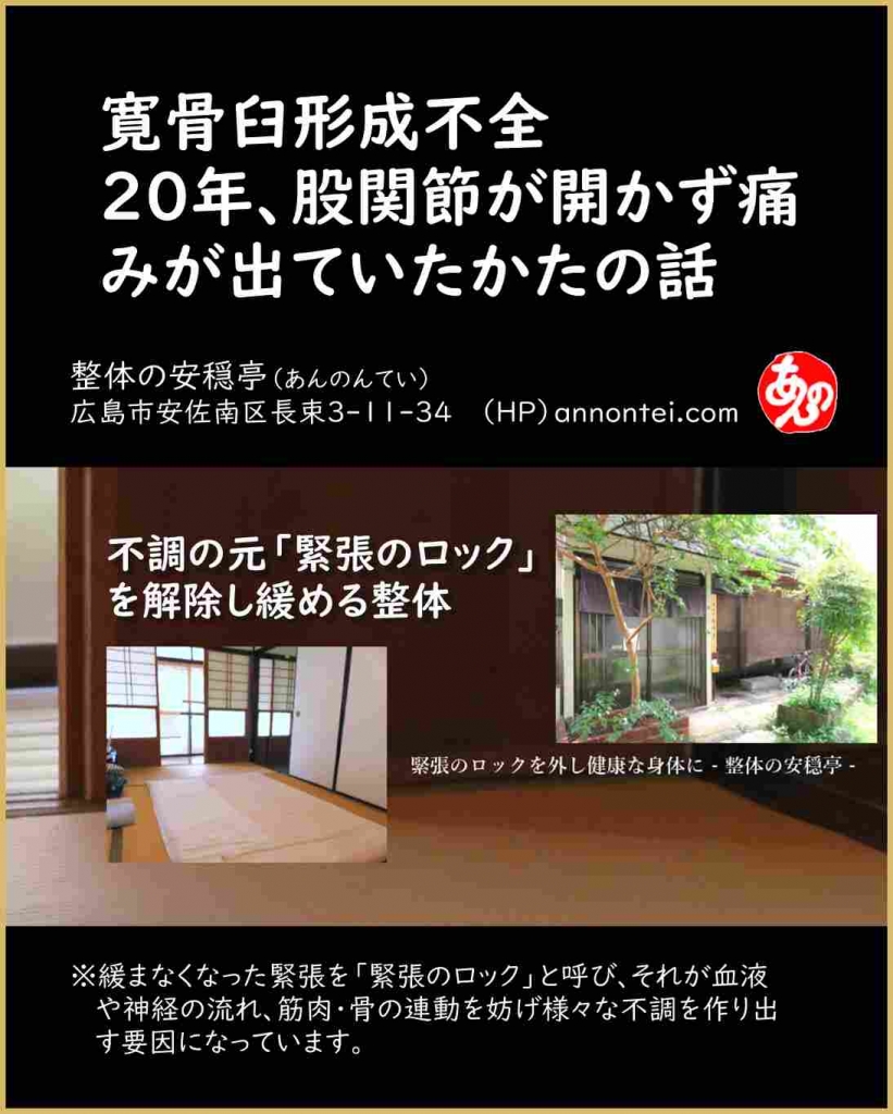エントリ画像