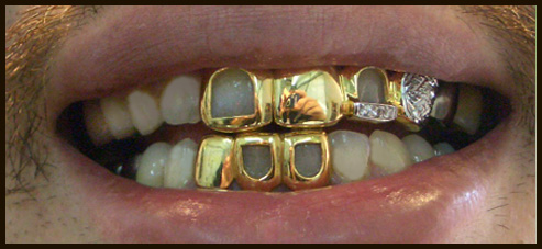 B.D.the Brobus~ THE GENESIS | Grillz Community B.D.the Brobus~ THE GENESIS | Grillz Community